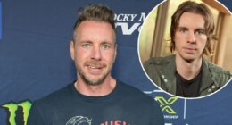 Dax Shepard Admits He Looks Like He Got 'Some Kind of Jaw Implant'