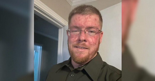 Deputy Derrick Bonham Shot, Killed in Line of Duty