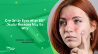 Dry Gritty Eyes After 50? Ocular Rosacea May Be Why