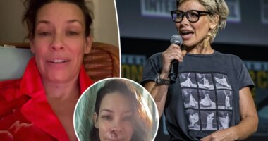Evangeline Lilly shares devastating brain injury months after falling face-first on boulder