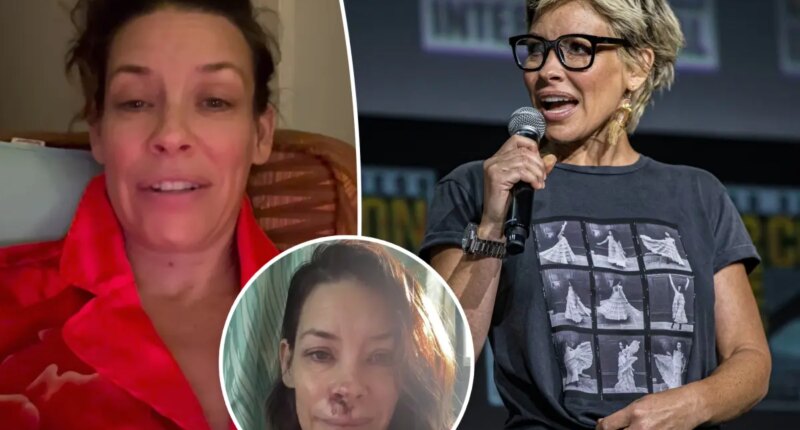 Evangeline Lilly shares devastating brain injury months after falling face-first on boulder