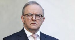 Prime Minister Anthony Albanese's reforms will be voted on next week.