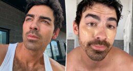 Joe Jonas swears these $14 under-eye patches are the ‘best out there’