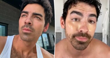 Joe Jonas swears these $14 under-eye patches are the ‘best out there’