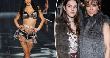 Lisa Rinna’s daughter Amelia Gray Hamlin breaks down all the cosmetic surgery procedures she’s had