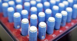 Ozempic pens in tray (Bloomberg/Getty)