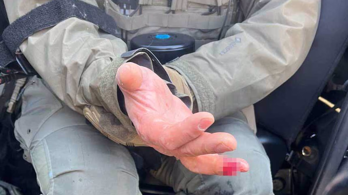 'Rioters bite off' officer's finger after deadly Minneapolis shooting