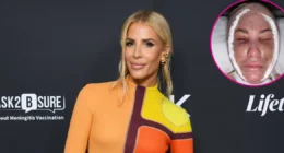 Tracy Tutor Shares Bandaged Selfie After Neck and Facelift: 'Pain and Swelling'