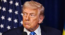 Trump claims to know cause of worrying hand bruises