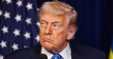 Trump claims to know cause of worrying hand bruises