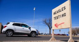 US hits one year of measles spread. CDC’s No. 2 calls outbreaks ‘cost of doing business’