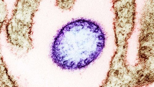 Nipah virus is frequently fatal and can leave survivors with brain damage.