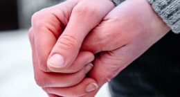 What is frostbite? Here’s how to spot the signs early