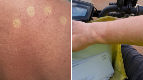 Posties told to stop wearing uniforms amid reports they're getting sunburnt