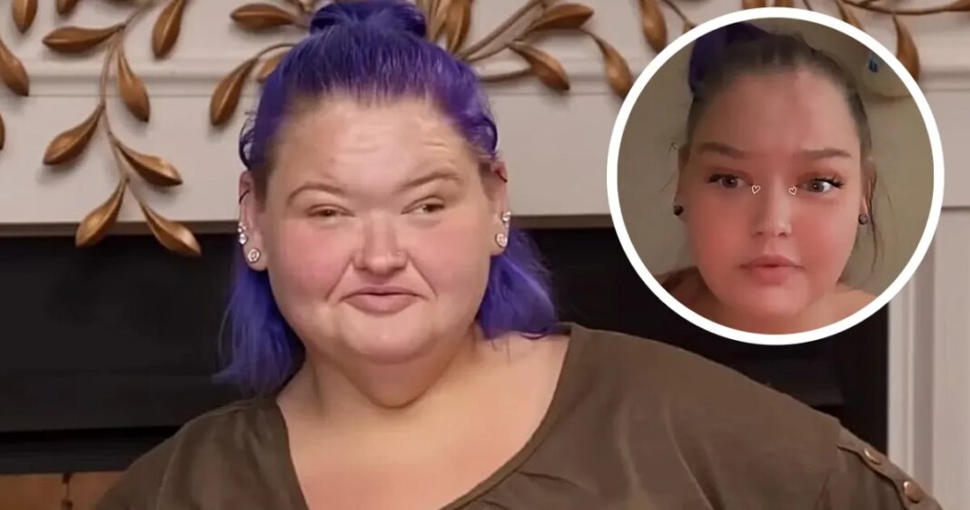 ‘1000-Lb Sisters’ Star Amy Slaton’s Successful Results of Lazy Eye Surgery Revealed - InTouch Weekly