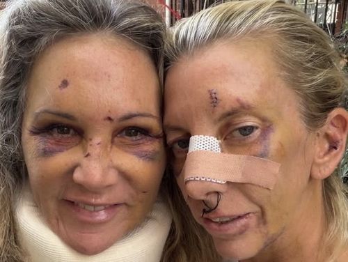 Instagram story showing Potts Point attack victimsChristine Campeau (left) and Chloe Paul.