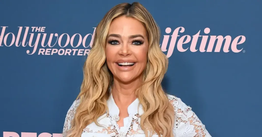 Denise Richards’ Plastic Surgeon Breaks Down Her Dramatic Facelift Surgery