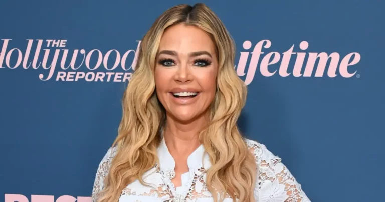 Denise Richards’ Stunning Transformation: Inside the Details of Her Dramatic Facelift by Top Plastic Surgeon