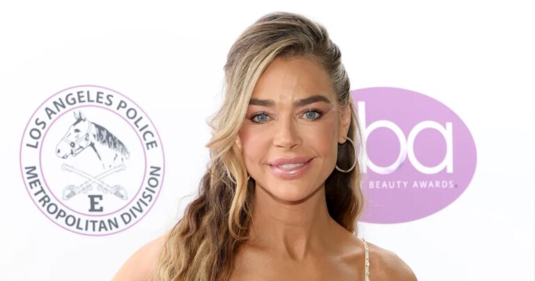 Denise Richards Stuns Fans with Dramatic Facelift Transformation: Exclusive Before-and-After Photos Unveiled