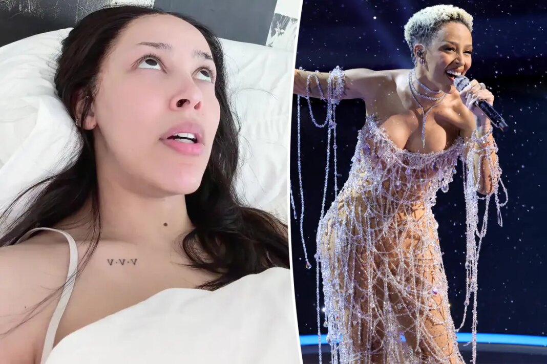 Doja Cat reveals borderline personality disorder diagnosis