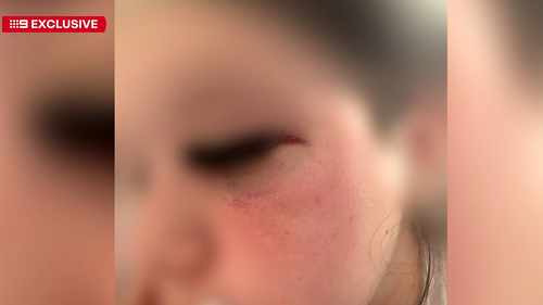 Girl attacked at Shellharbour shopping centre