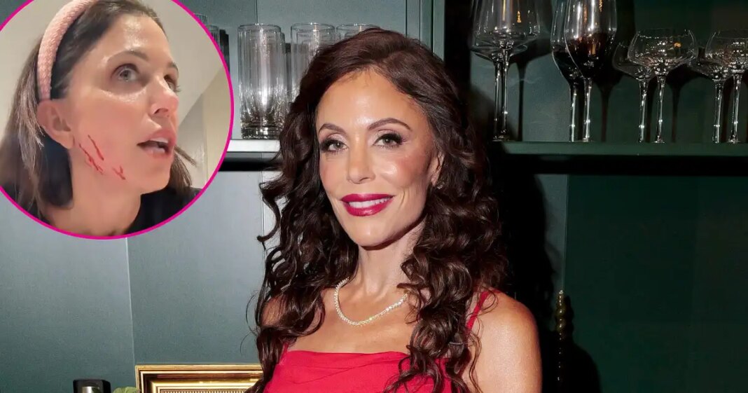 What Happened to Bethenny Frankel’s Face? Nurse Jamie Controversy Explained