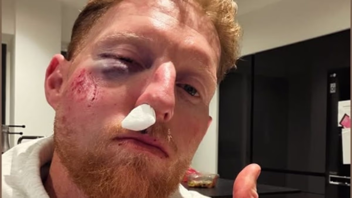 Ben Stokes reveals he is 'lucky' to be alive after horror cricket injury left England captain's face a 'mess' and requiring major surgery: 'Thankfully I'm still here'