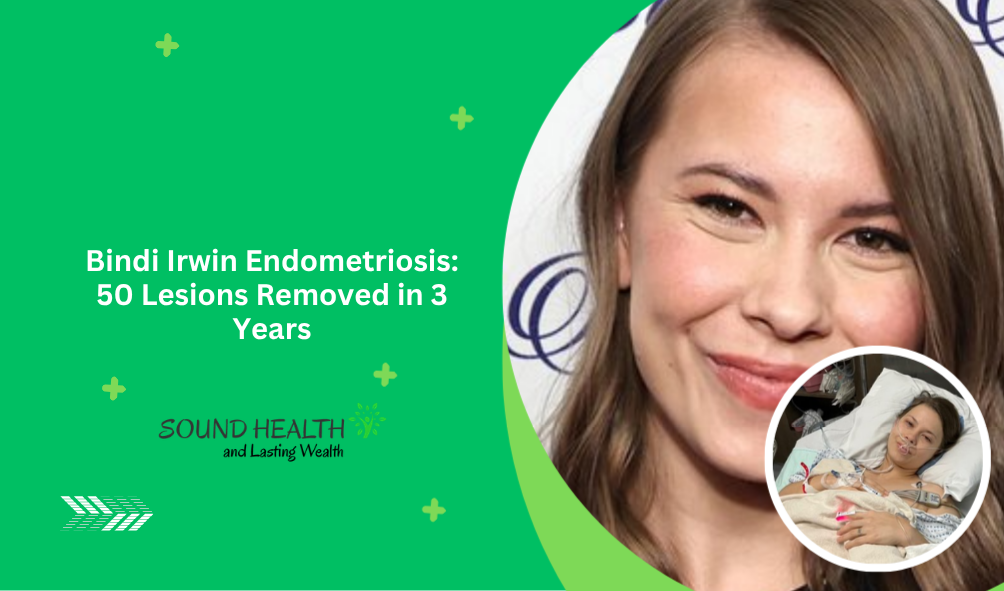 Bindi Irwin Endometriosis: 50 Lesions Removed in 3 Years