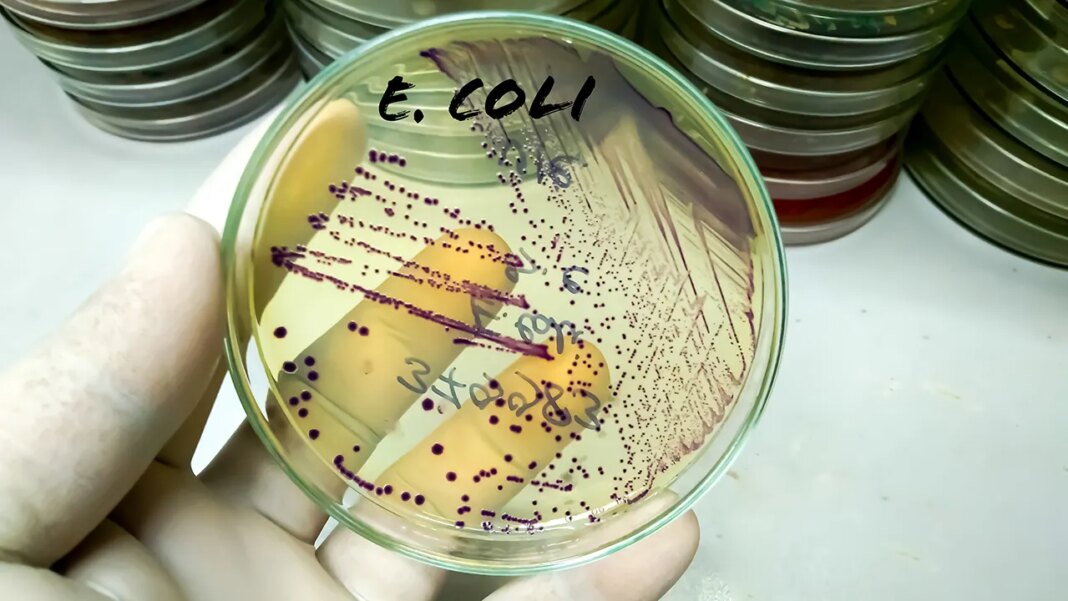 Chinese researcher on US visa pleads guilty to smuggling E. coli into the country