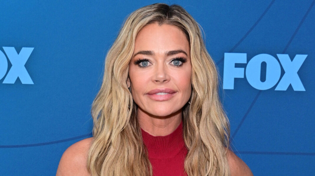 Denise Richards' Impressive Facelift Is Betrayed By Unfiltered Look At This Body Part