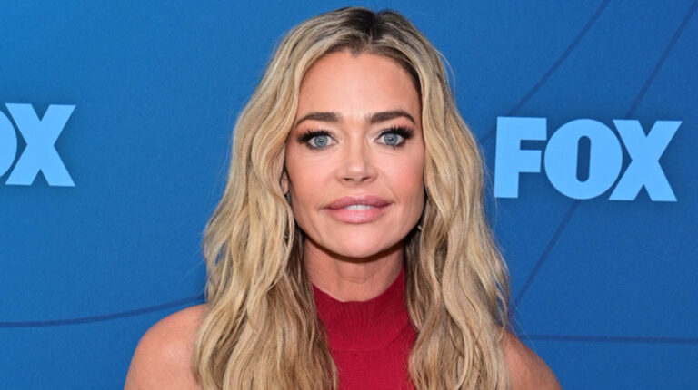 Denise Richards’ Natural Look Reveals Surprising Facelift Details