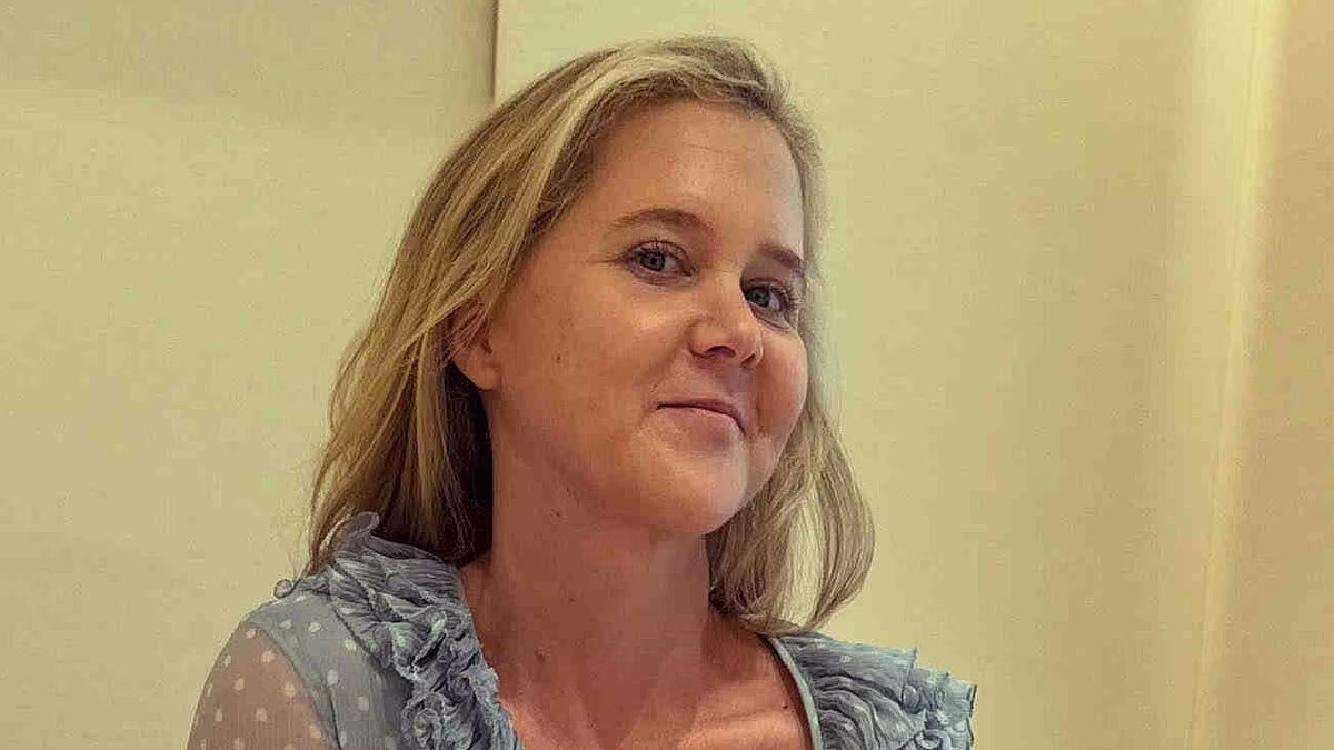 Amy Schumer reveals a 'botched' medical procedure