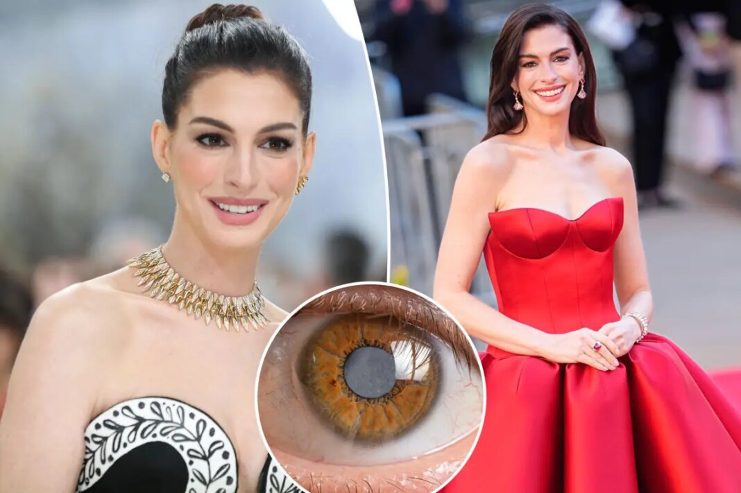 Anne Hathaway's secret decade-long medical condition left her nearly blind throughout her 30s