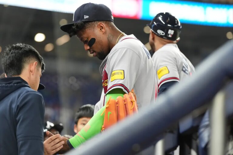 Ronald Acuna Jr. Leaves Game, Adding to Braves’ Growing Concerns