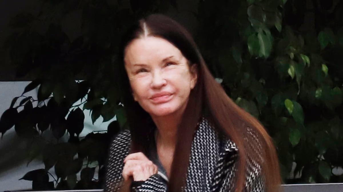 See Janice Dickinson BEFORE plastic surgery following her facelift