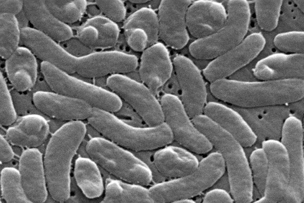 Vibrio season is here: How can you avoid the flesh-eating bacterial infection?
