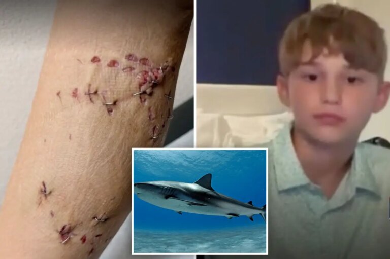 Quick-Thinking Brother Rescues 12-Year-Old from Shark Encounter on Bahamas Vacation