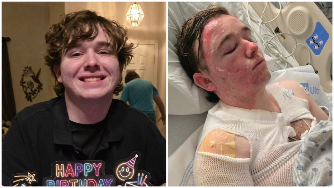Co-worker throws hot oil on California McDonald's employee, 20-year-old badly burned