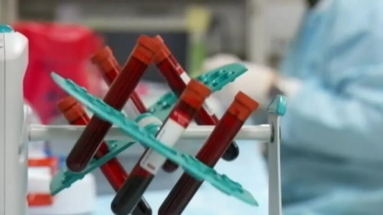 Unlocking Health: The Critical Importance of Early HIV Detection
