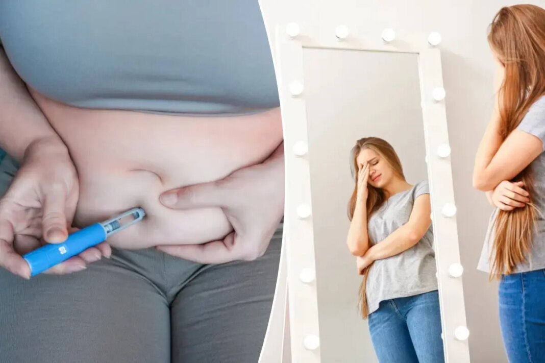 People are battling 'ghost fat' after losing weight on GLP-1s