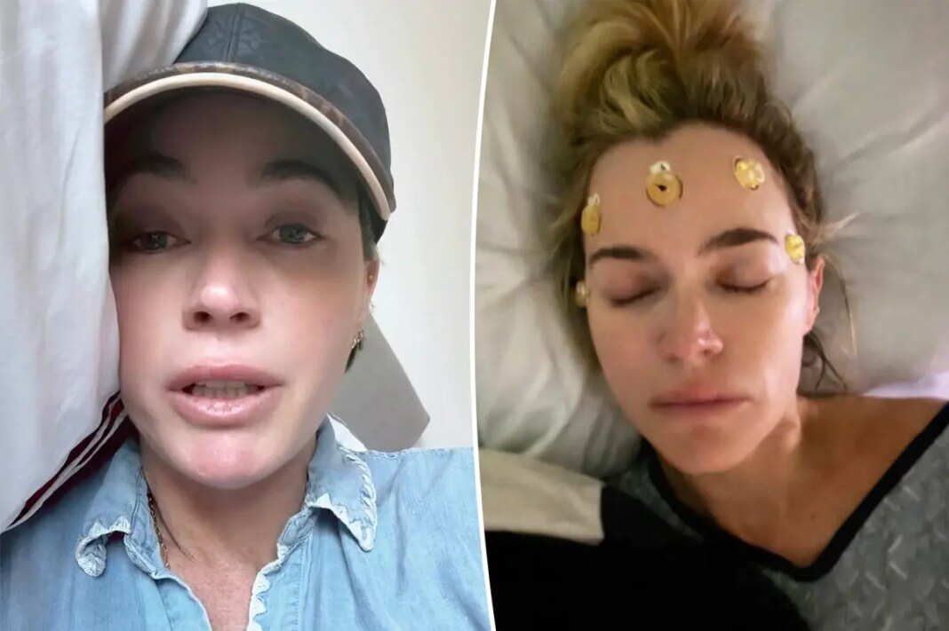 Teddi Mellencamp gives rare update on what 'cancer recovery looks like' in tearful video