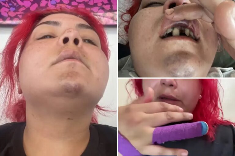 SoCal World Cup Celebrations Turn Violent as Fan Attacked by Robber After Watch Party