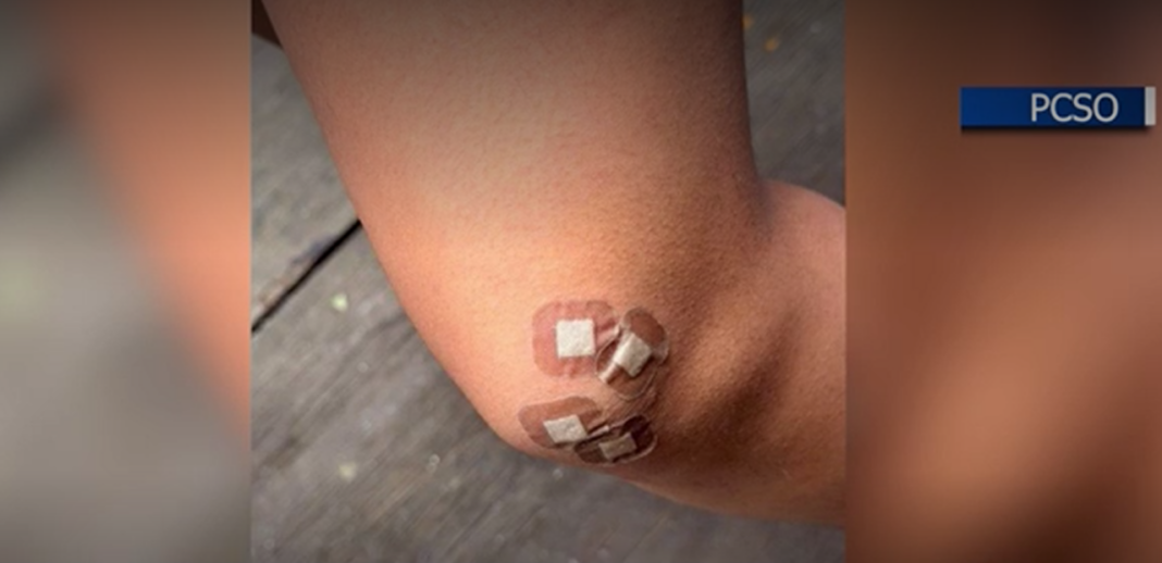 ‘It’s really concerning’: Lakeland residents speak after 5 people, puppy attacked by rabid cat