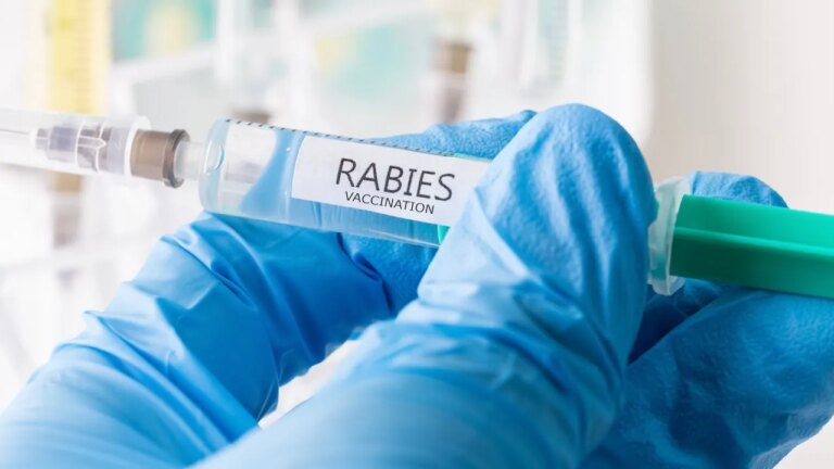 Tragic Rabies Case: 11-Year-Old Succumbs After Bat Encounter in Sleep