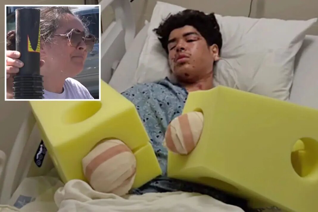 California mom goes ballistic after teen son's hands are blown to pieces on 4th of July