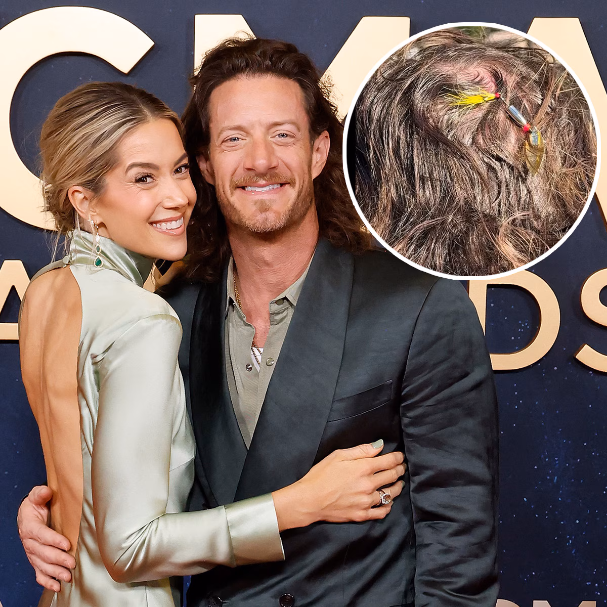 Florida Georgia Line's Tyler Hubbard Gets Fish Hook Removed From Head