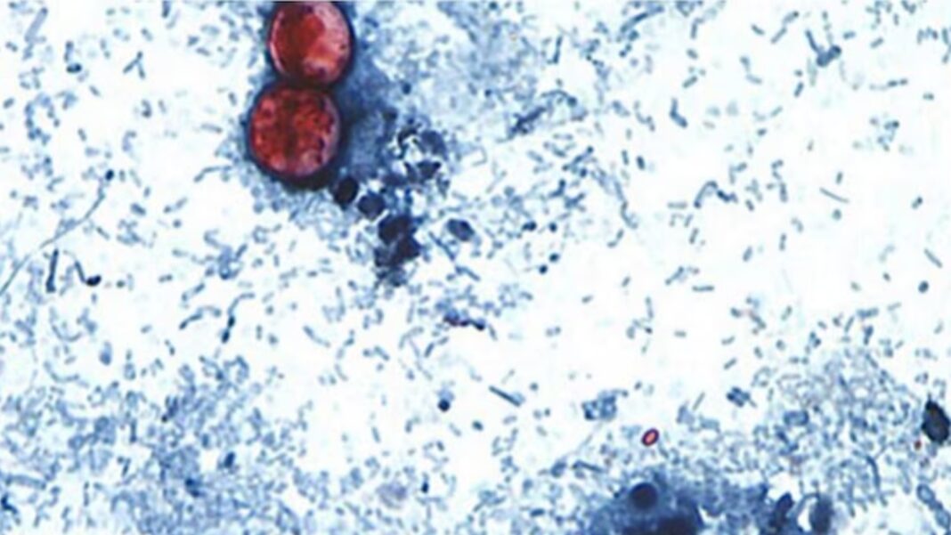 Parasite outbreak causing 'explosive diarrhea' reported in 17 US states, CDC warns