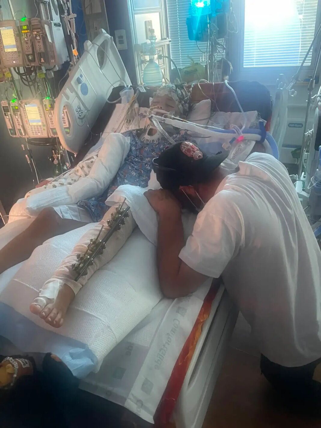 Pasco County 10-year-old hit by 2 cars opens eyes after falling into coma