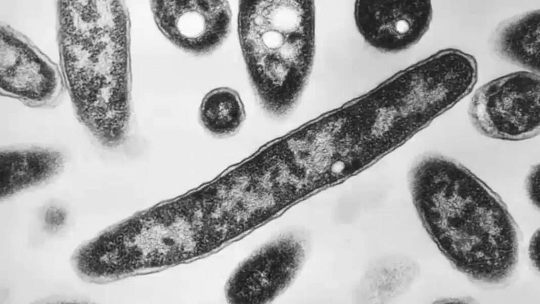 Second death reported in Legionnaires' disease outbreak in New York City