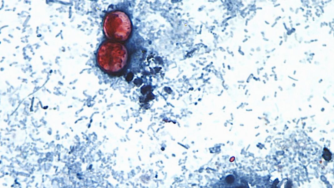 What we still don't know about the cyclosporiasis outbreak as cases rise